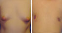 Before & After Photos